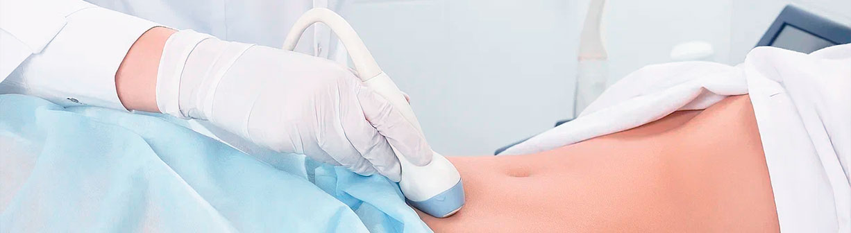 3D УЗИ органов малого таза у женщин