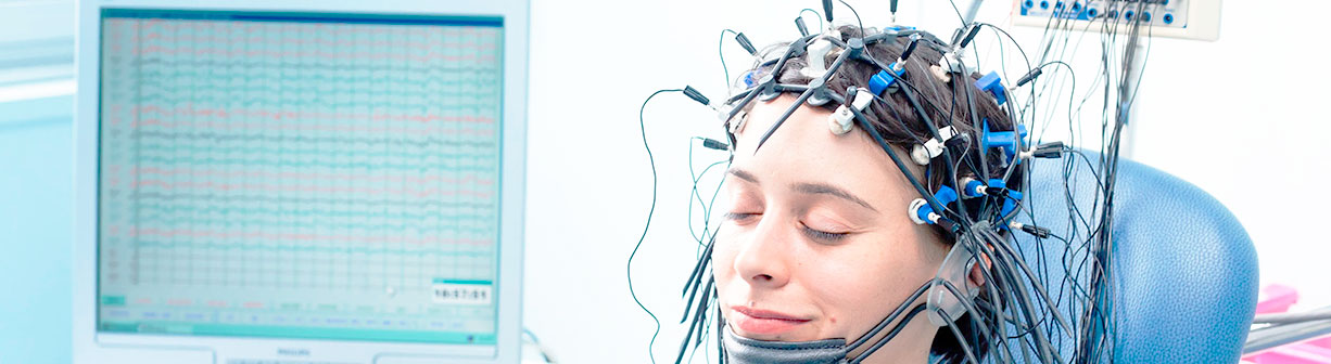 Электроэнцефалография (ЭЭГ) головного мозга