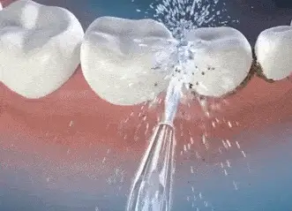 Содоструйная чистка зубов