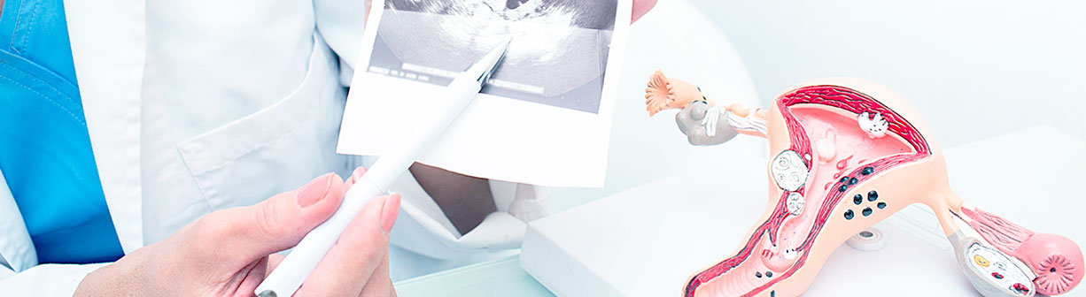 Гинекология